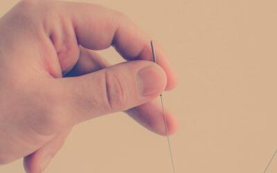 acupuncture-41