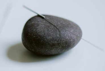 acupuncture-45