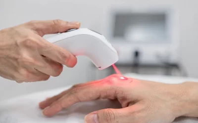aplicacion-de-acupuntura-laser-con-un-dispositivo–1769380066352