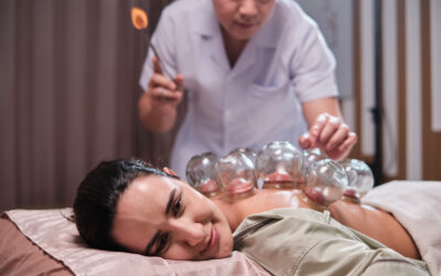 A Latino woman is treated with cupping therapy by Asian physical therapist.
